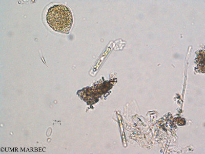phyto/Scattered_Islands/europa/COMMA April 2011/Ostreopsis sp (ancien Dino r)(copy)_thumb.jpg